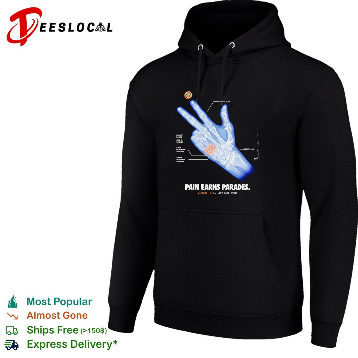 Pain earns parades hand x ray shirt