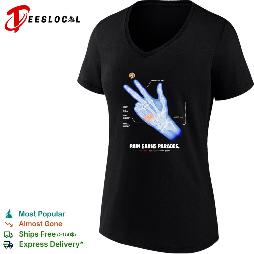 Pain earns parades hand x ray shirt