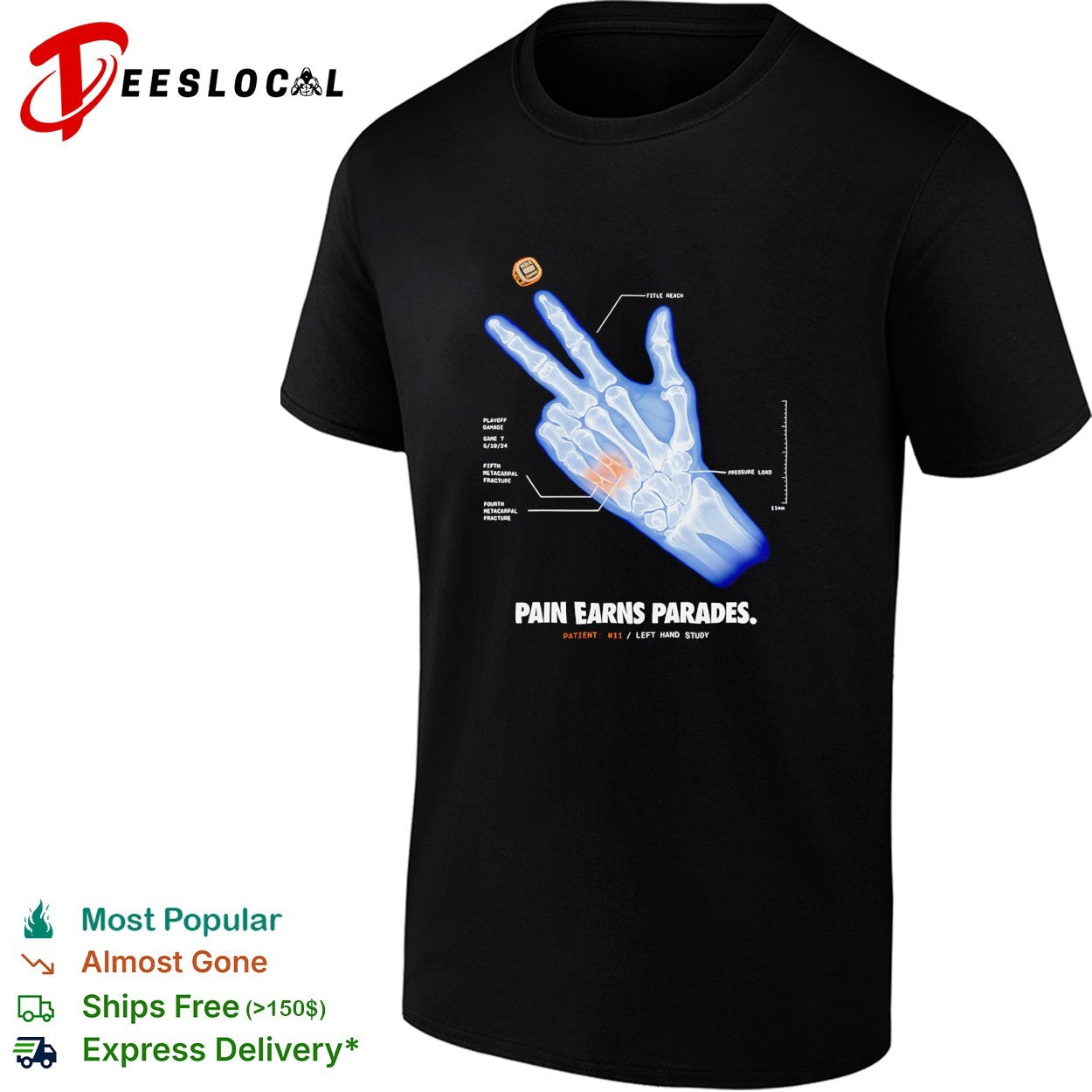 Pain earns parades hand x ray shirt